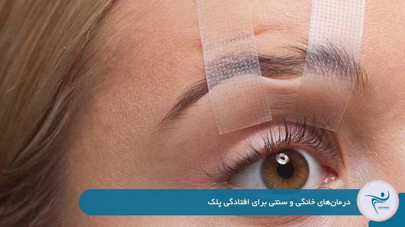 درمانهای خانگی و سنتی برای افتادگی پلک