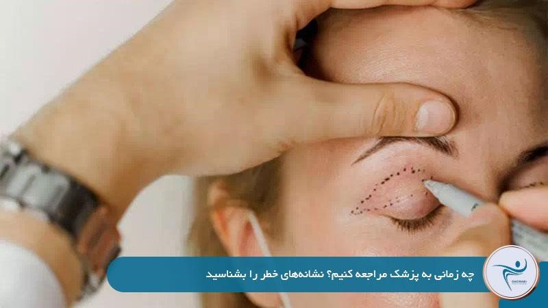 چه زمانی برای افتادگی پلک به پزشک مراجعه کنیم؟