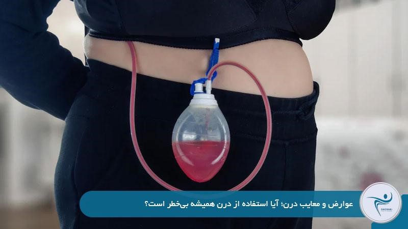 عوارض و معایب درن