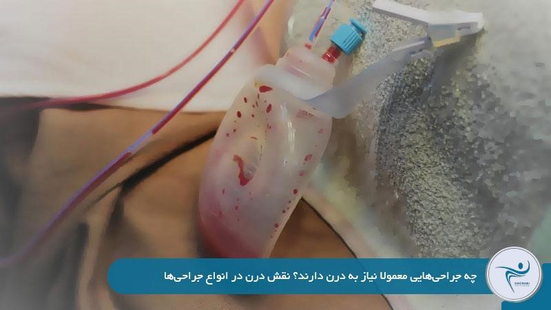 چه جراحیهایی نیاز به درن دارند؟
