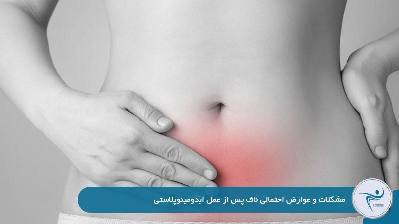 عوارض عمل ابدومینوپلاستی برای ناف