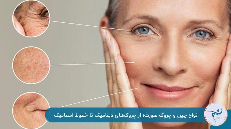خداحافظی با انواع چین و چروک صورت