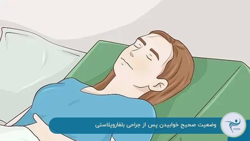 وضعیت صحیح خوابیدن پس از جراحی بلفاروپلاستی