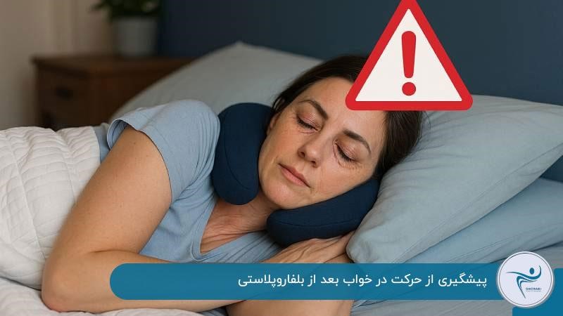 نحوه خوابیدن بعد از عمل بلفاروپلاستی