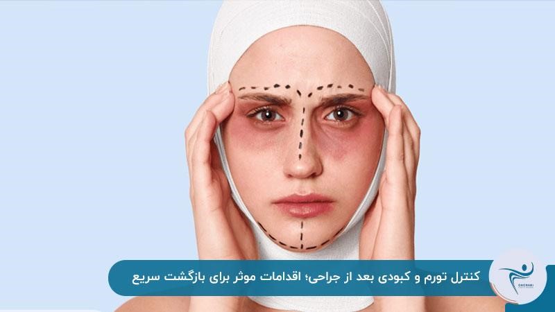 از بین بردن تورم و کبودی بعد از جراحی لیفت صورت