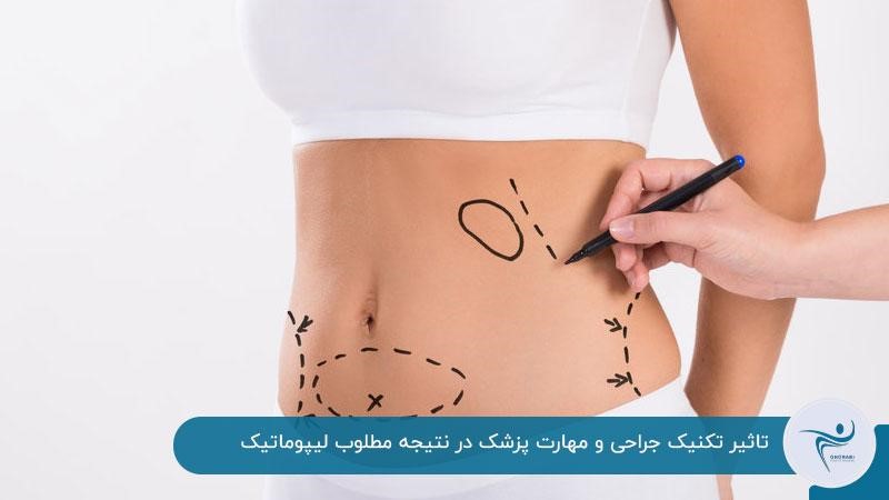 علت ناهمواری پوست بعد از لیپوماتیک