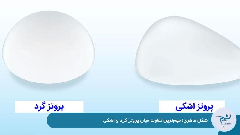 شکل ظاهری؛ مهم‌ترین تفاوت میان پروتز گرد و اشکی