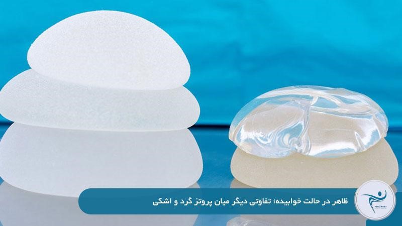 پروتز اشکی بهتر است یا گرد؟