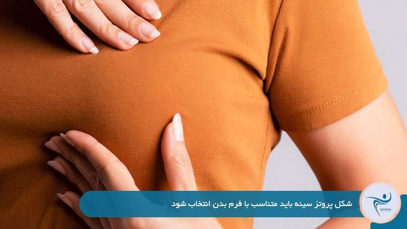 توجه به فرم بدن؛ فاکتوری مهم در انتخاب میان پروتز اشکی و گرد