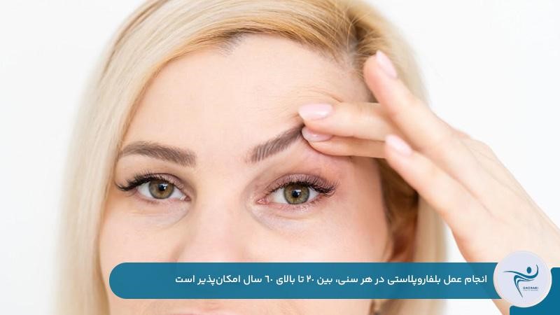 بهترین سن برای عمل بلفاروپلاستی بین 20 تا 60 سالگی