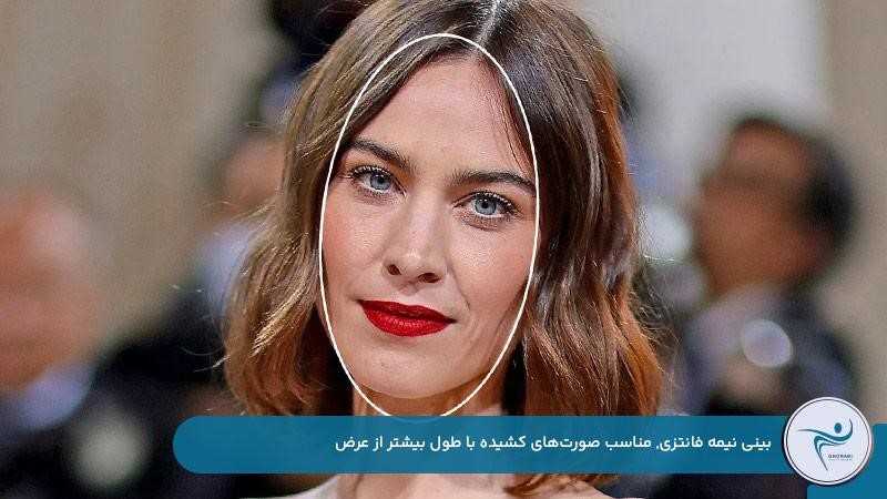 بینی نیمه‌فانتزی با قد بلند و قوس ملایم مناسب صورت‌های کشیده