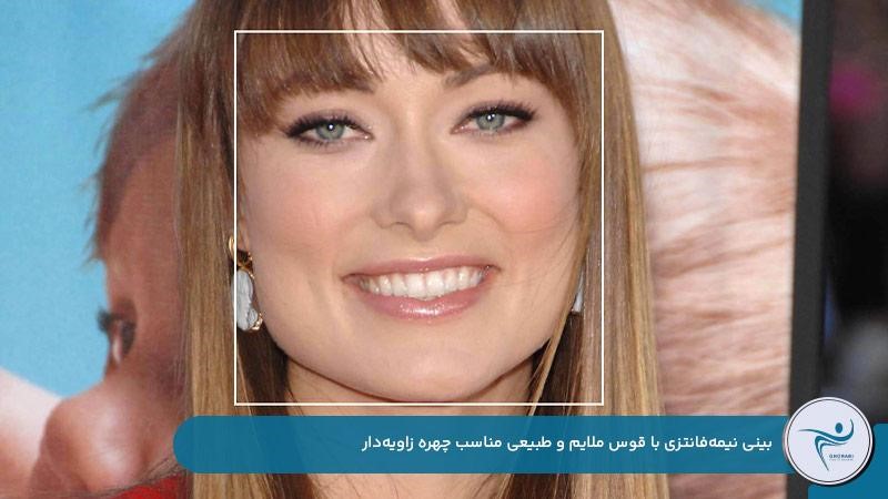 بینی نیمه‌فانتزی با قوس کم و ظاهری طبیعی مناسب چهره‌های مربعی و زاویه‌دار