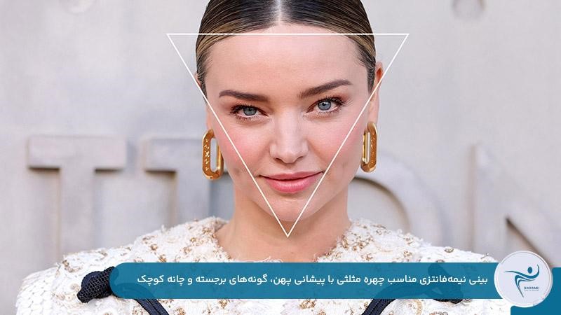 بینی نیمه‌فانتزی با اندازه نسبتا کوچک مناسب چهره‌های مثلثی 