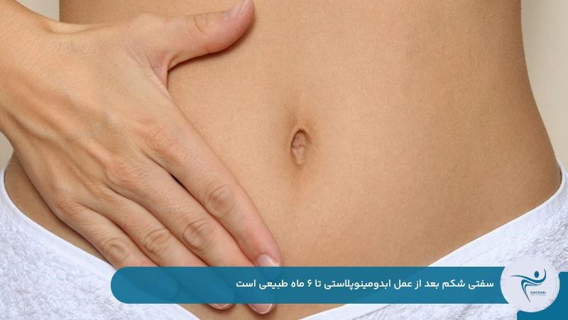 سفت شدن شکم بعد از عمل ابدو تا شش ماه