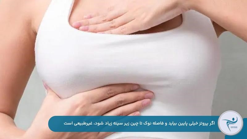 غیرطبیعی بودن پايين آمدن سینه بعد از عمل پروتز 