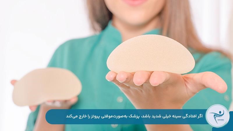 خارج کردن پروتز به‌صور‌ت‌موقتی در صورت افتادگی شدید