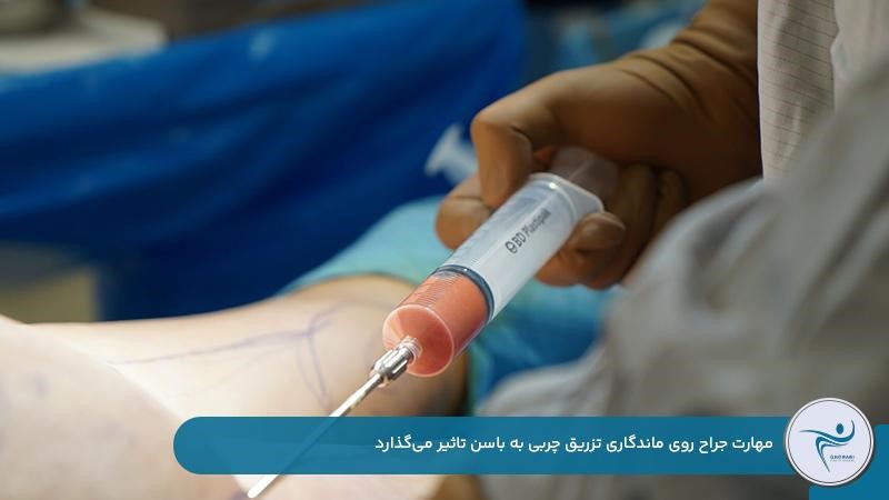 تاثیر مهارت جراح بر ماندگاری تزریق چربی به باسن 
