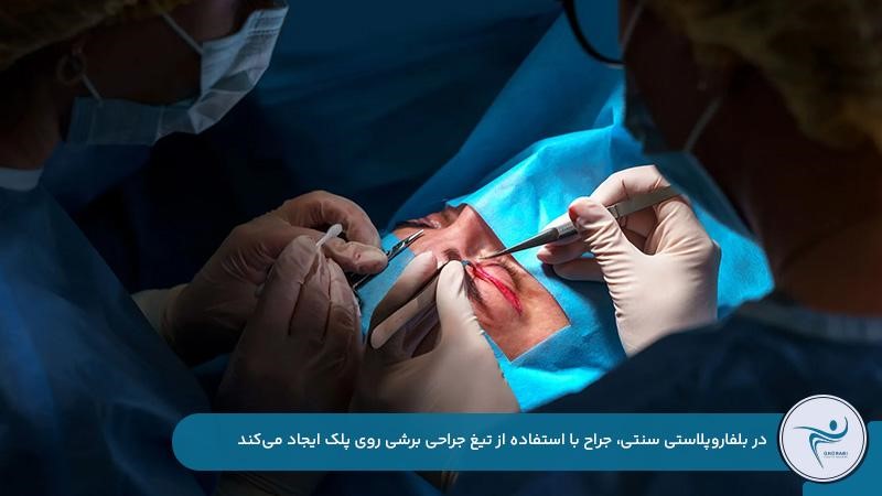 انجام بلفاروپلاستی سنتی با ایجاد برش ولی بلفاروپلاستی لیزری با استفاده از اشعه لیزر
