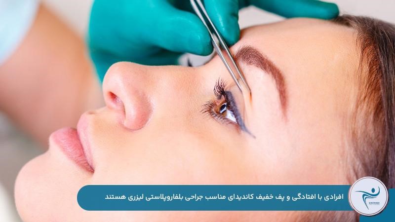 جراحی بلفاروپلاستی لیزری مناسب افرادی با افتادگی پلک خفیف