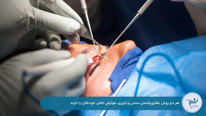 تفاوت عوارض بلفاروپلاستی لیزری و سنتی 