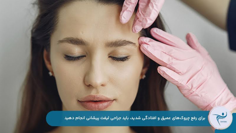از بین بردن چروک پیشانی با جراحی لیفت