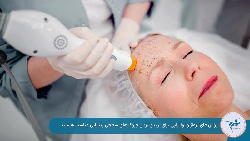 از بین بردن چروک پیشانی با ترماژ و اولتراپی