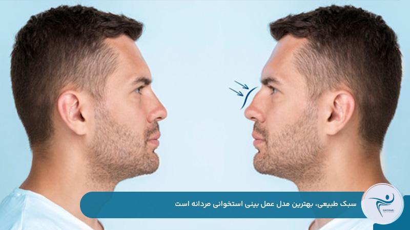 سبک طبیعی؛ بهترین مدل عمل بینی استخوانی مردانه