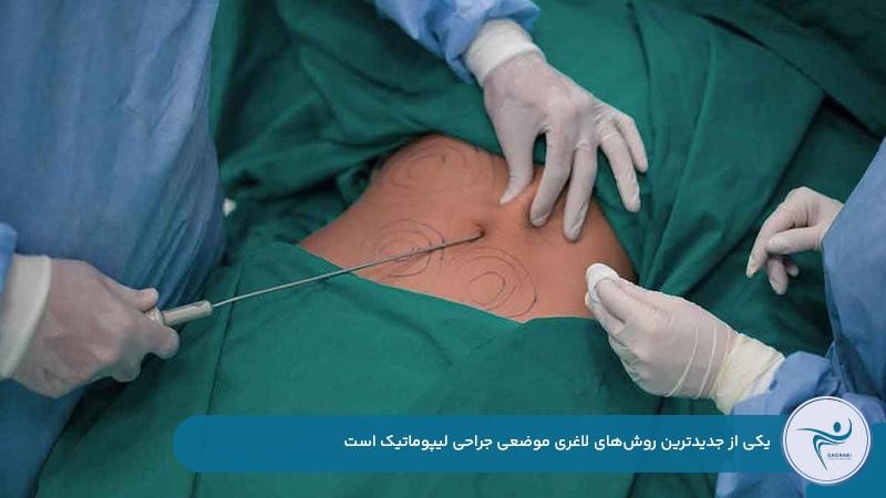 جراحی لیپوماتیک برای لاغری موضعی 
