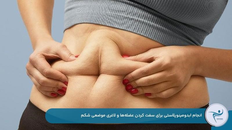 ابدومینوپلاستی برای لاغری موضعی شکم
