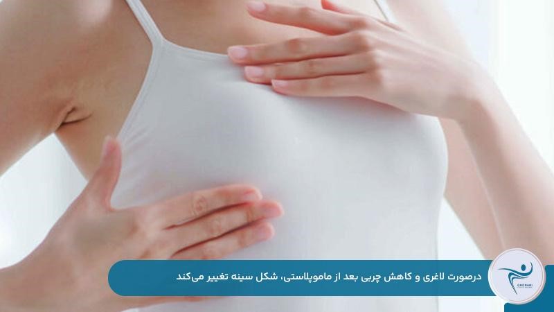 تغییر شکل سینه‌ها به دلیل لاغری بعد از ماموپلاستی