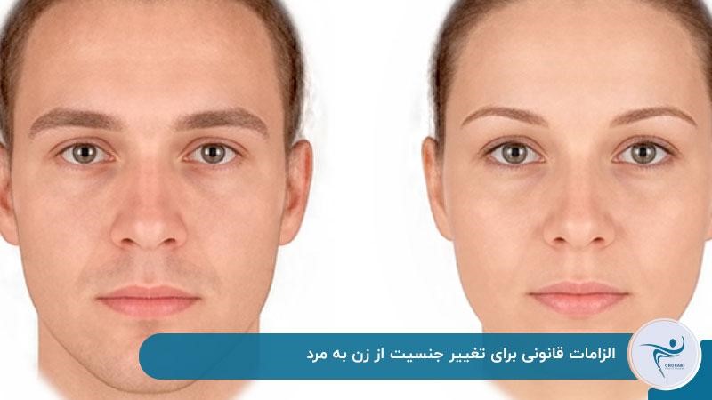 الزامات قانونی برای تغییر جنسیت از زن به مرد