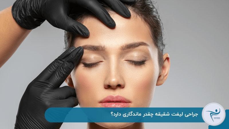جراحی لیفت شقیقه چقدر ماندگاری دارد؟ 