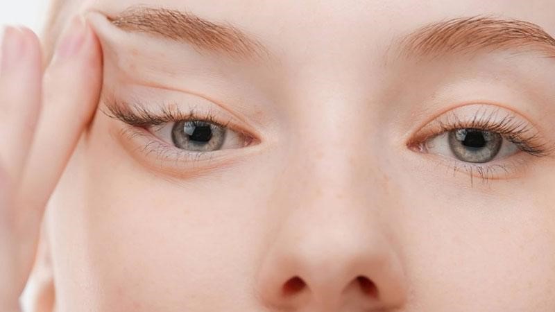 ماندگاری لیفت شقیقه