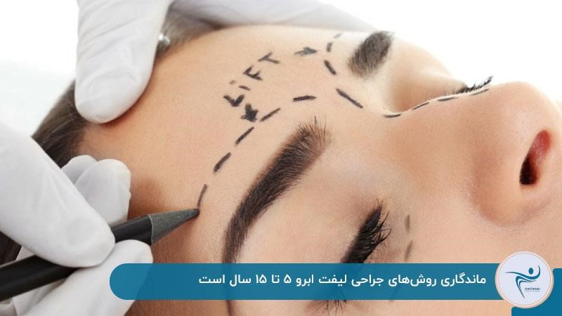 لیفت ابرو با جراحی چقدر ماندگاری دارد