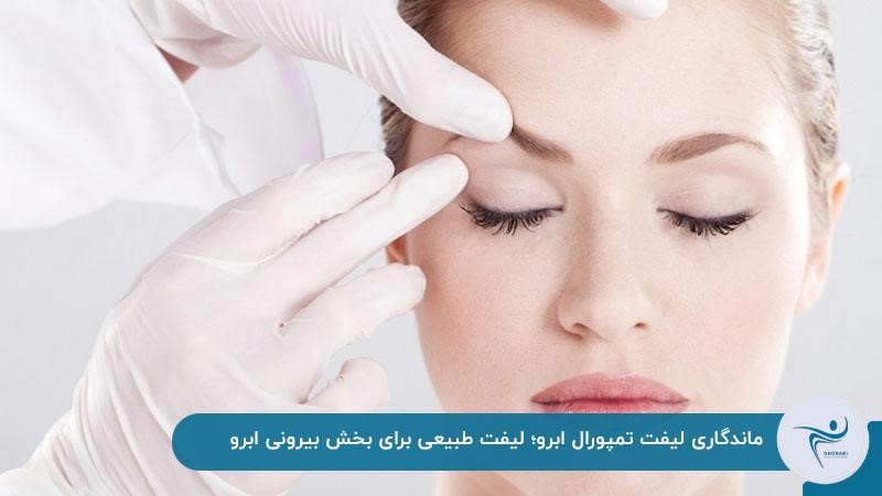 ماندگاری لیفت تمپورال ابرو