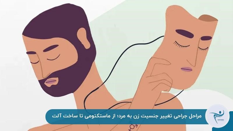 مراحل جراحی تغییر جنسیت زن به مرد