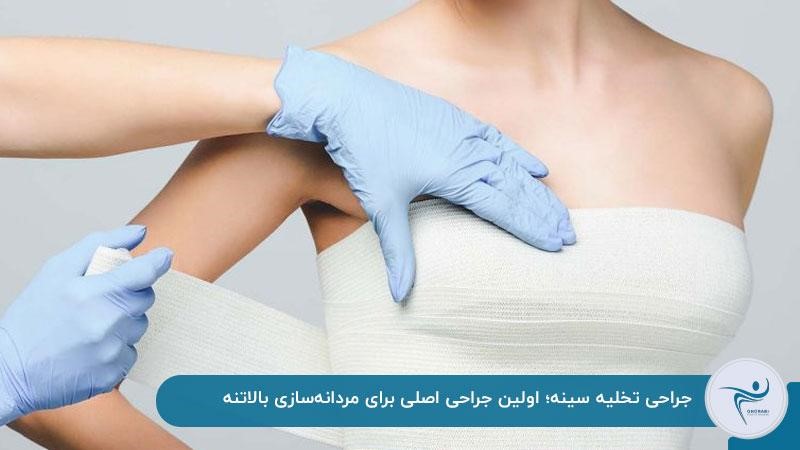 جراحی تخلیه سینه برای تغییر جنسیت