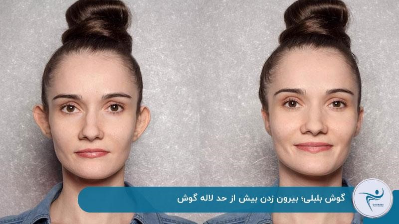 عکس گوش بلبلی