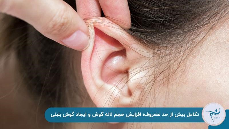 تکامل بیش از حد غضروف و ایجاد گوش بلبلی