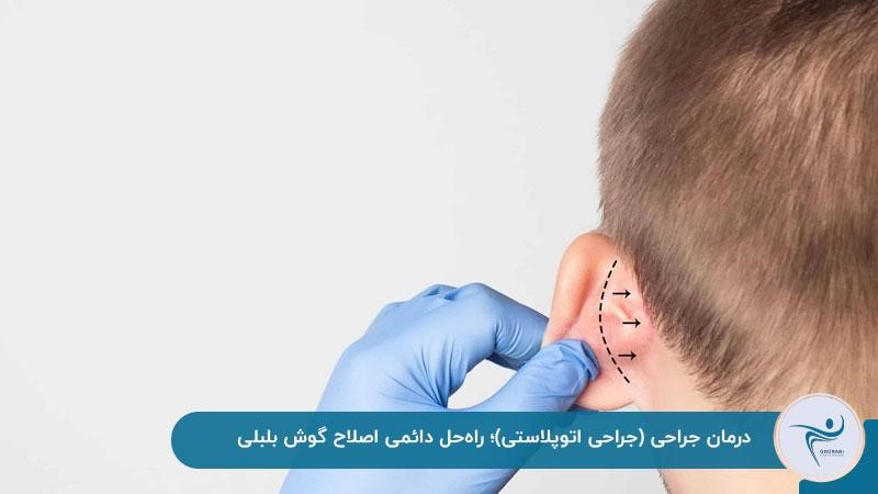 جراحی اتوپلاستی برای اصلاح گوش برجسته