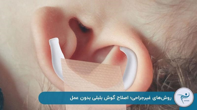 اصلاح گوش بلبلی بدون عمل