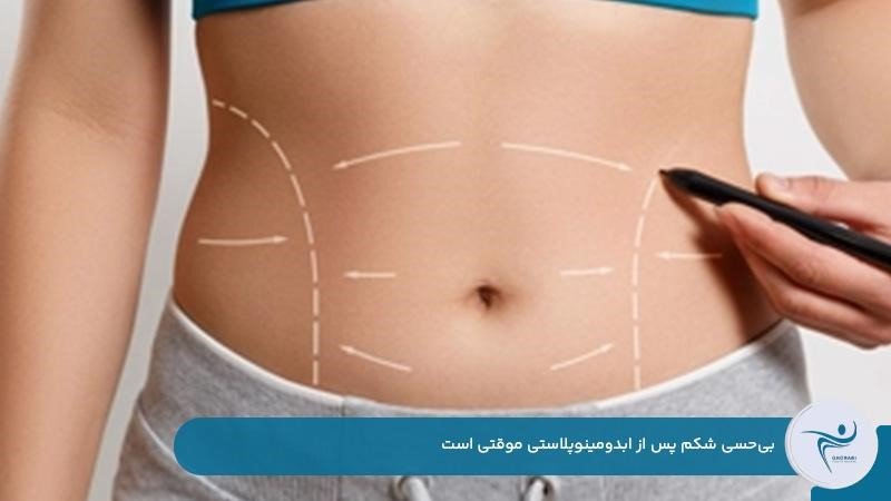 موقتی بودن بی حسی شکم بعد از ابدومینوپلاستی
