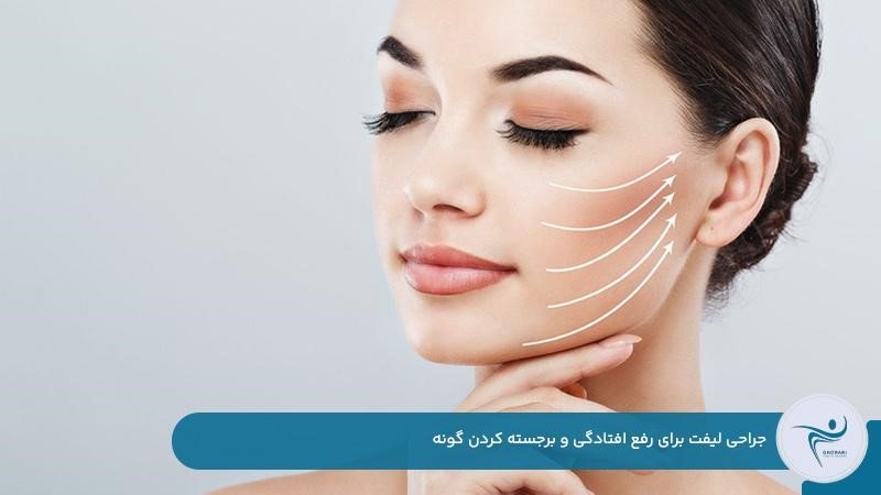 انجام جراحی لیفت برای برطرف کردن افتادگی و برجسته کردن گونه