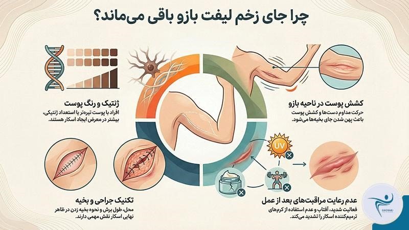 دلیلهای ماندن جای بخیه لیفت بازو