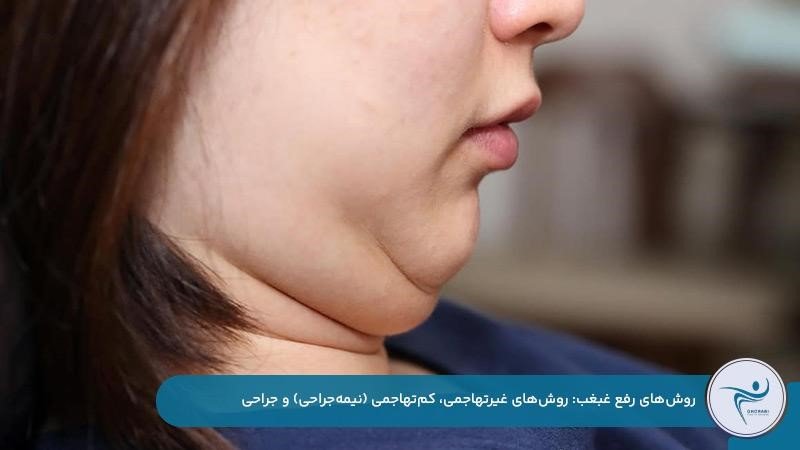روشهای جراحی، نیمهجراحی و غیرتهاجمی برای رفع سریع غبغب