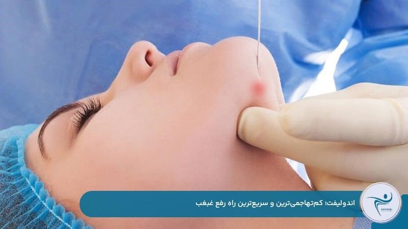 اندولیفت یکی از روشهای کمتهاجمی برای رفع غبغب