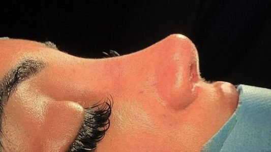بررسی این‌که نوک بینی گرد بهتره یا تیز در مجله دکتر غرابی
