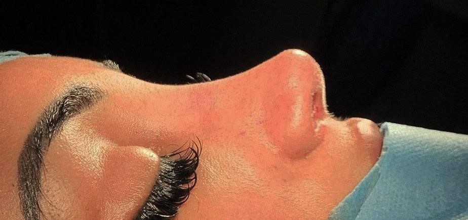 بررسی این‌که نوک بینی گرد بهتره یا تیز در مجله دکتر غرابی