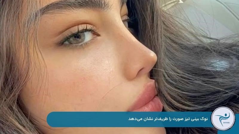 ظریفتر نشان دادن چهره با نوک بینی تیز