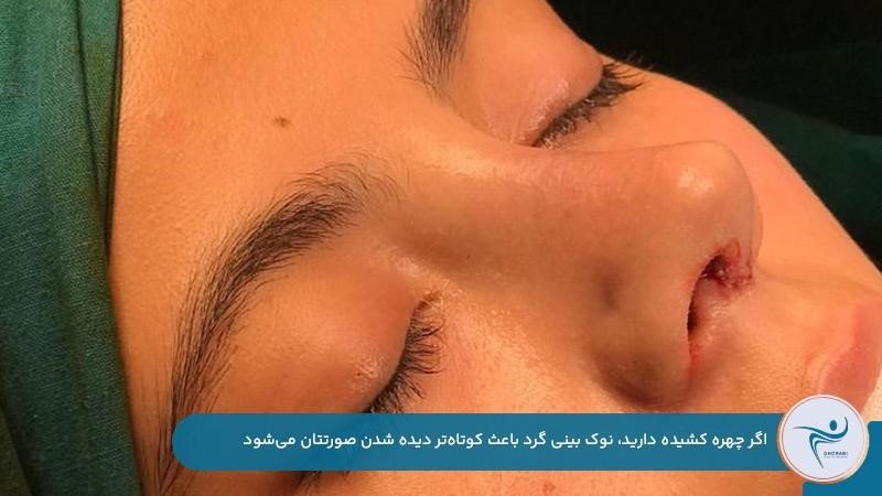 نوک بینی گرد مناسب چهرههای کشیده